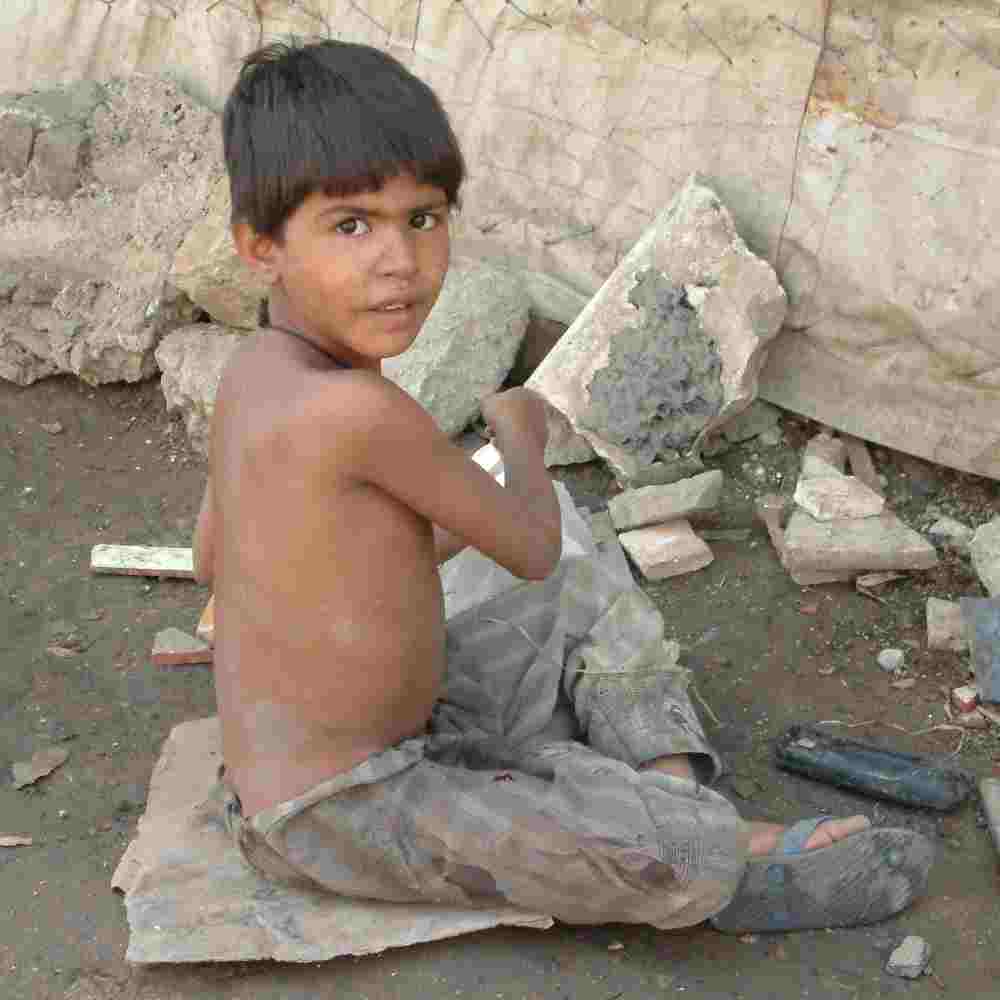 Malnourished boy in poverty living in the slums